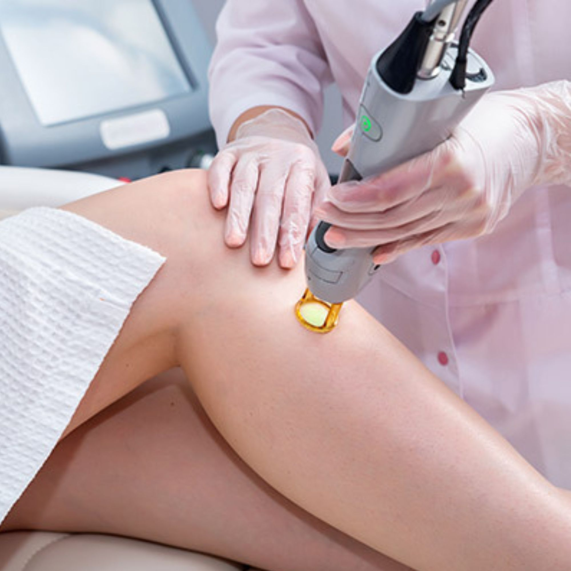 Laser Hair Removal